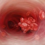 Blood Cells Block Therapy Blood Cells