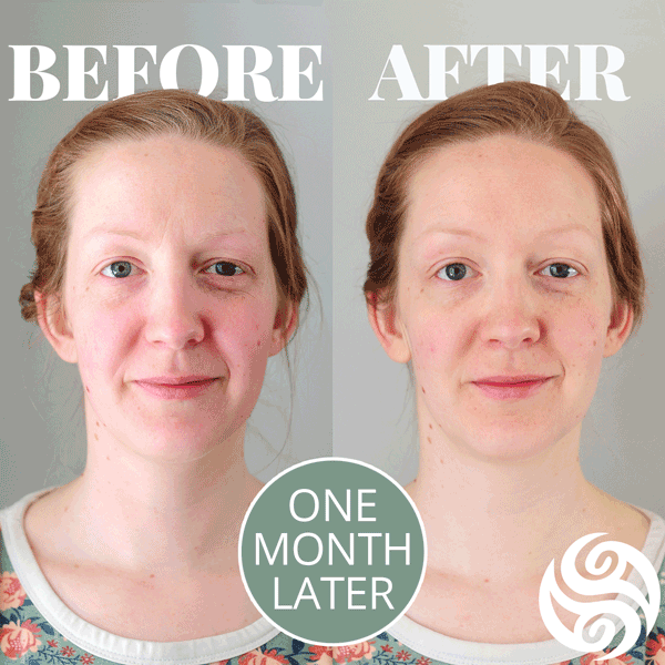 Erin Before and after